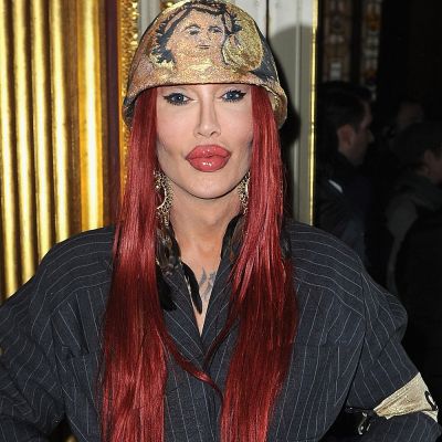 Was She Transgender? Transformation And Surgery Details