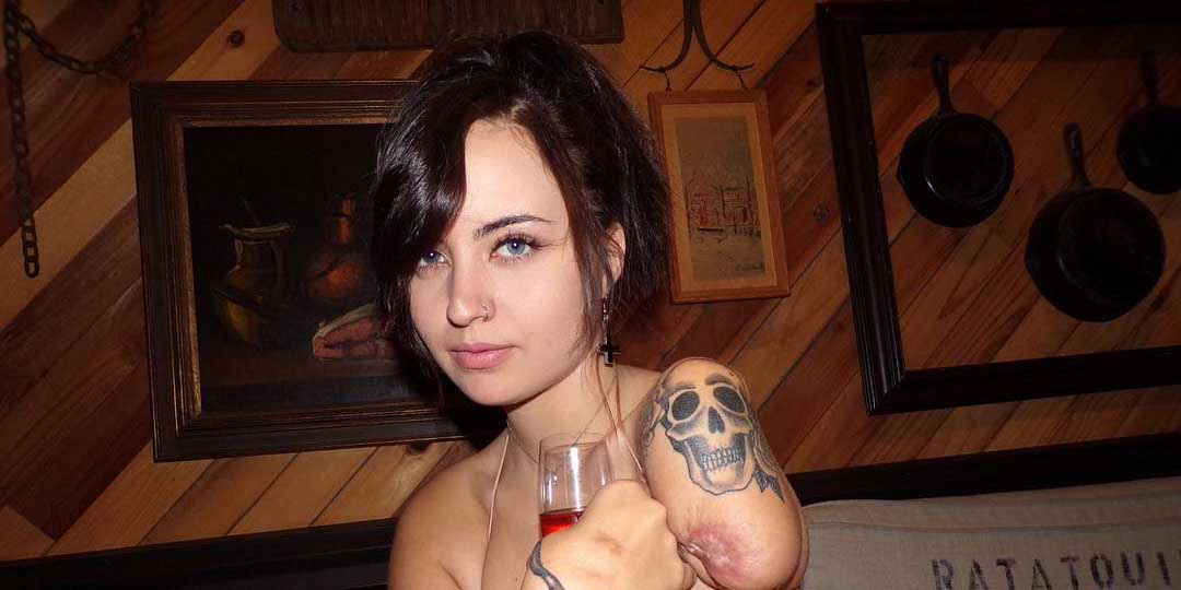 Where is Lauren Duck now? Wiki, age, boyfriend, arm accident