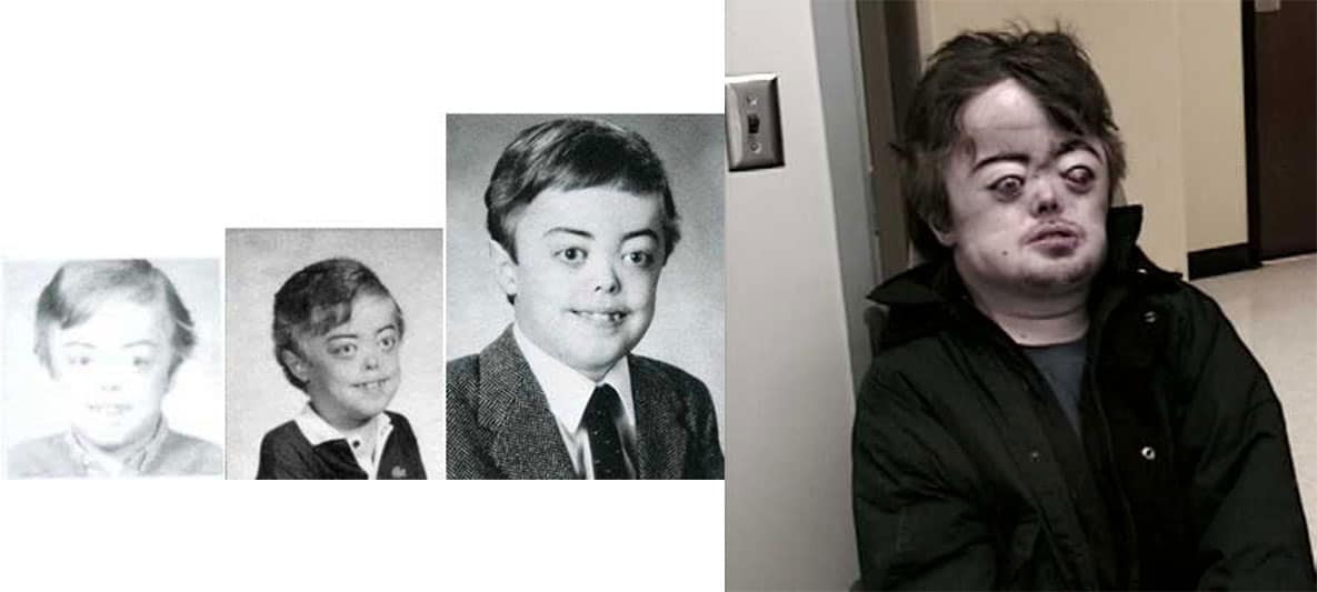 When and how did Brian Peppers die? Who was he REALLY? Wiki Bio