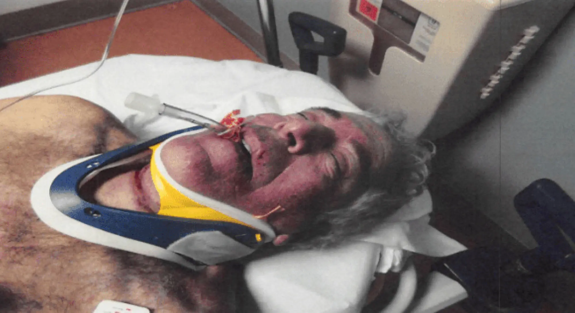 new jeffrey epstein autopsy pics 120325453