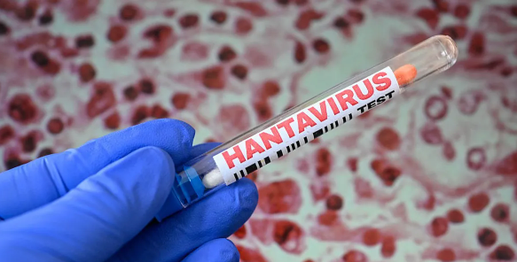 Understanding Hantavirus Diagnostics. How Modern Testing Supports Early Detection