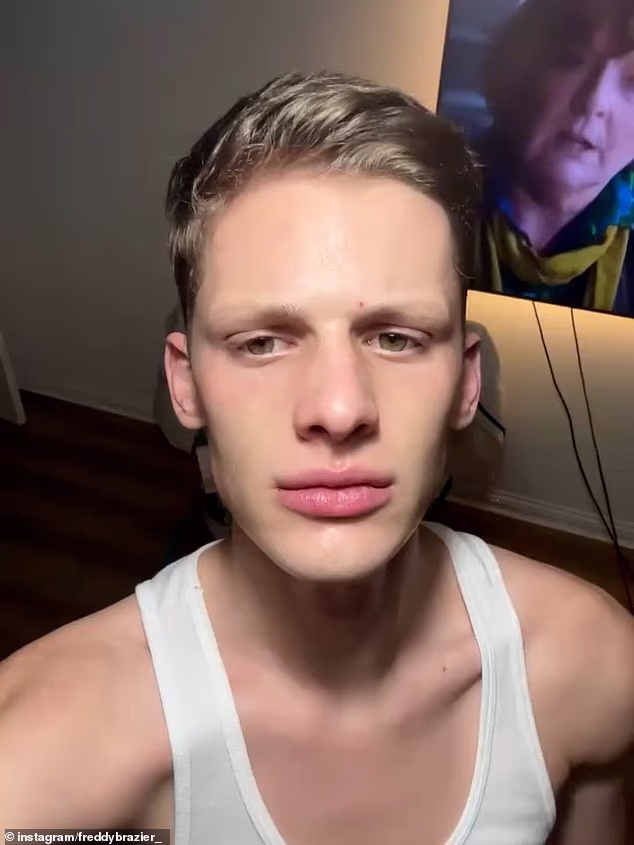 Freddy Brazier's pet dog Pablo won't be put down despite leaving him with a hole in his arm and attacking his nan Jackiey Budden - as vets believe 'urine infection affected his behaviour'